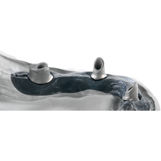 Titanabutment Noble Biocare active Tapered Conical inkl....