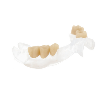 Design & Fertigung Eldy Plus aus STL